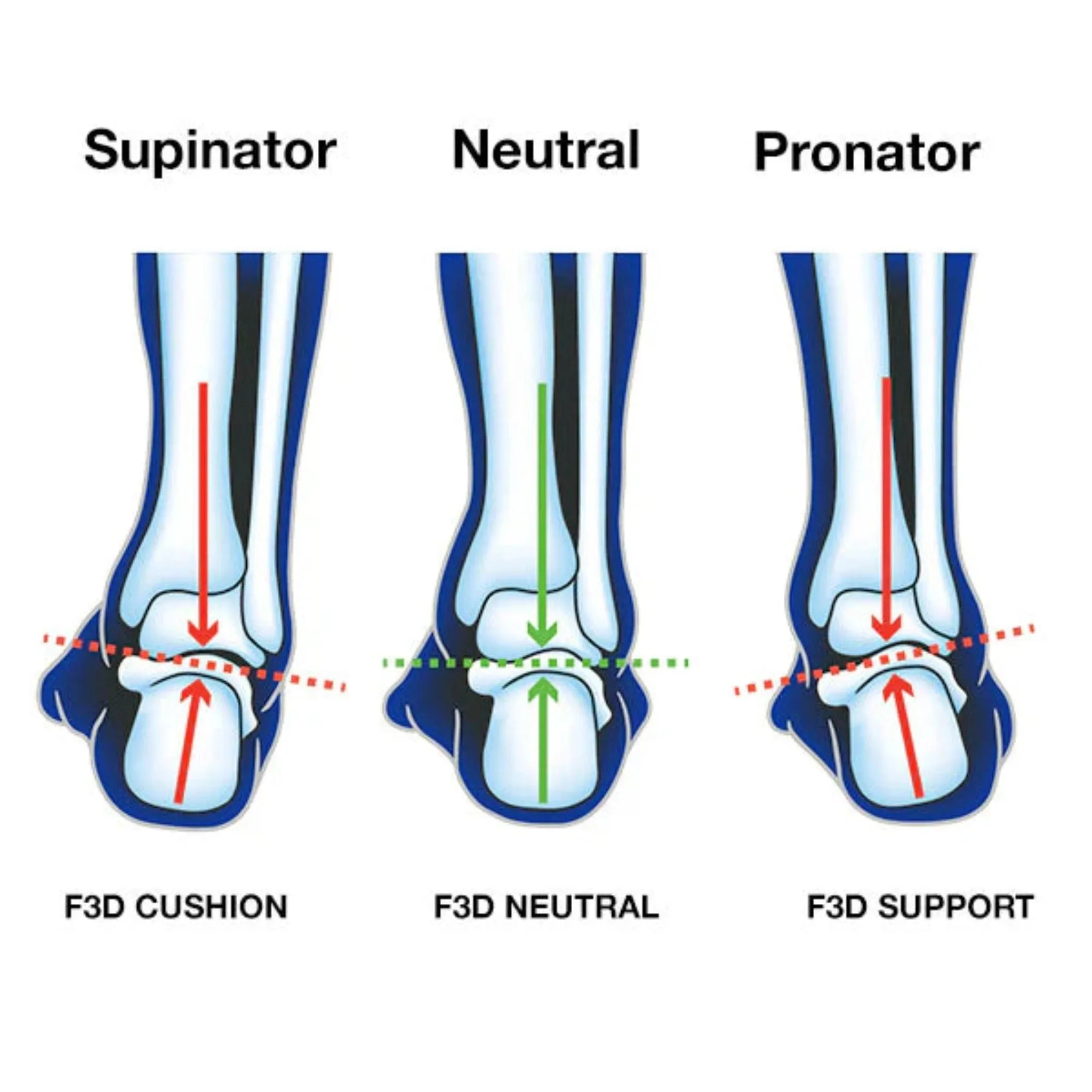 UP Advanced Insole - Support 